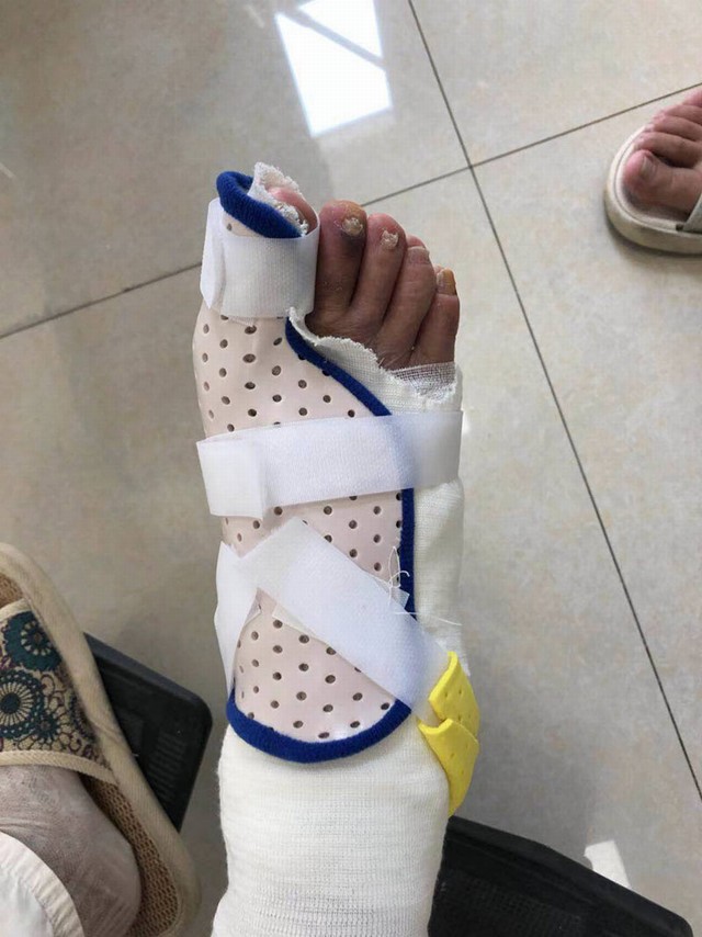 大拇指低温