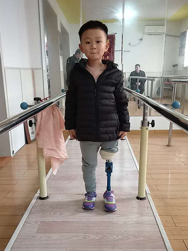 康复实例